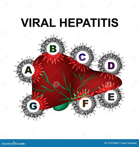 Types of Viral Hepatitis: Hepatitis A, B, C